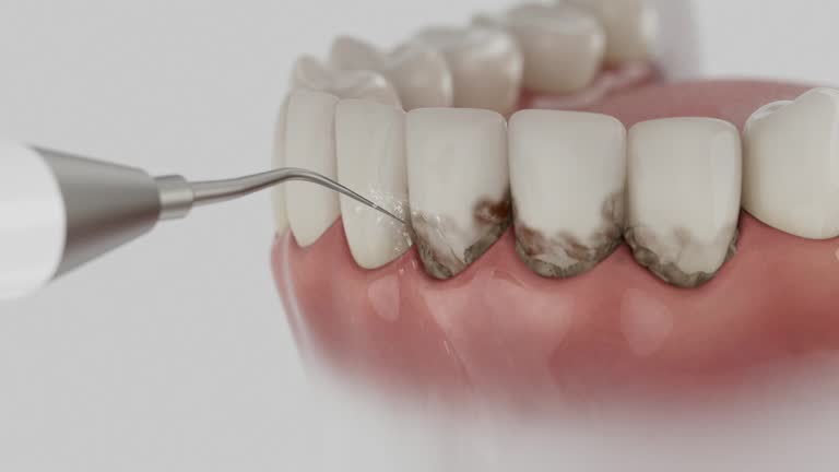 Trusted Invisalign Clear Aligners service in Tompkinsville, KY - Dentist Open Now